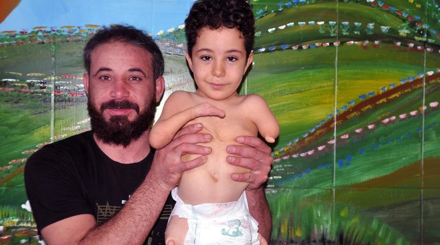 2 bacağı ve 1 kolu olmayan minik Mustafa: Erdoğan amca, y&uuml;r&uuml;mem i&ccedil;in yardım et