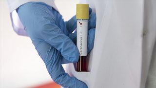 Vitesse'de 8 kişi koronavirüse yakalandı