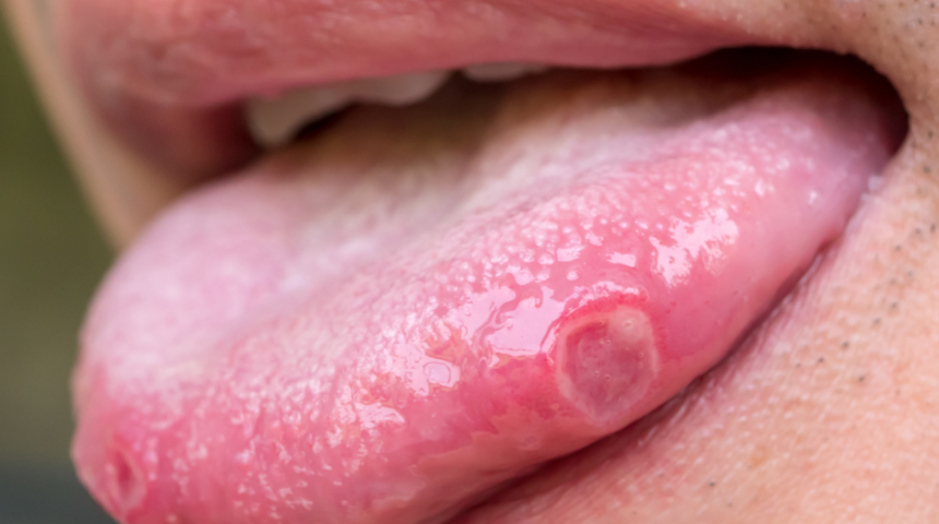 Dilinizin size sağlığınız hakkında anlatmaya &ccedil;alıştığı 9 şey! Yanma hissi varsa...