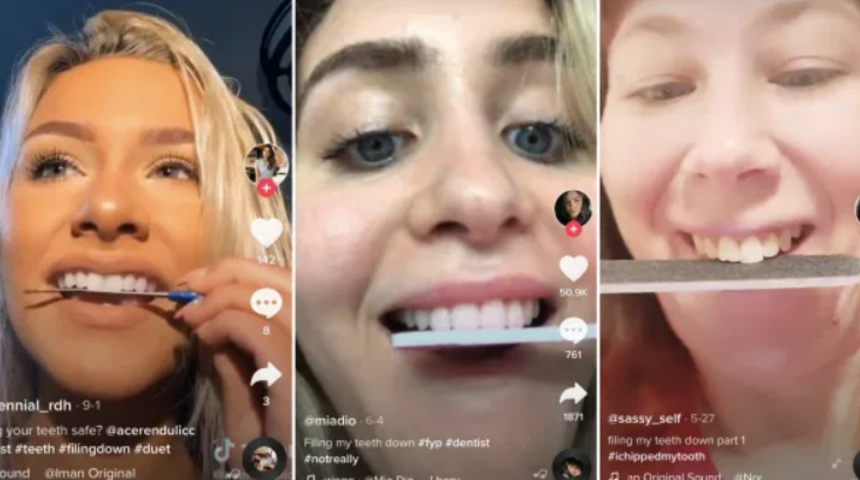 Tüyleri diken diken eden TikTok akımı! Diş törpüleme trendi tepki çekiyor