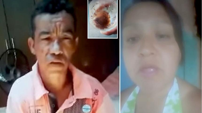 Kendisine tecavüz etmeye kalkan eski sevgilisinin cinsel organını ısırıp kopardı 