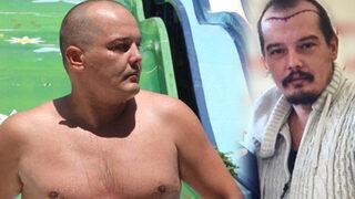 Arda Kural ilk adımı attı, saç ektirdi