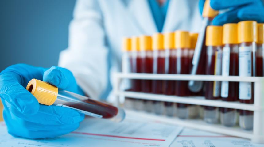 Kişinin kendi kanı ile tedavi hangi hastalıklarda kullanılır? Uzmanlardan alerji tedavisi uyarısı!