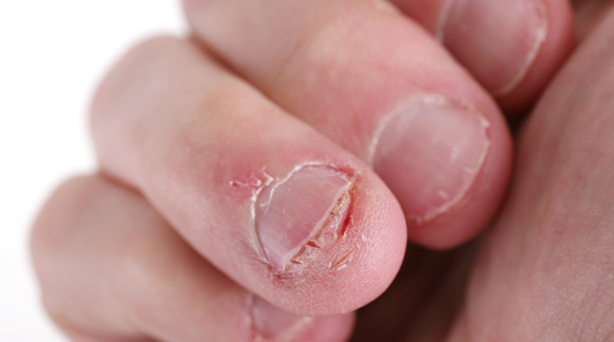 Pek &ouml;nemsemiyoruz ama tırnaklarınızdaki bu değişikliklere dikkat!