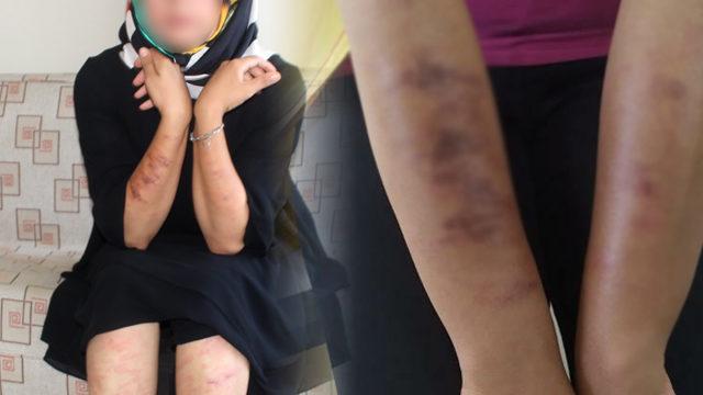 Genç kadın gittiği güzellik merkezinde dehşeti yaşadı!