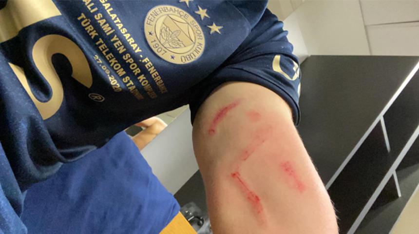 Fenerbahçe, Ferdi Kadıoğlu'nun son halini paylaştı! Luyindama...