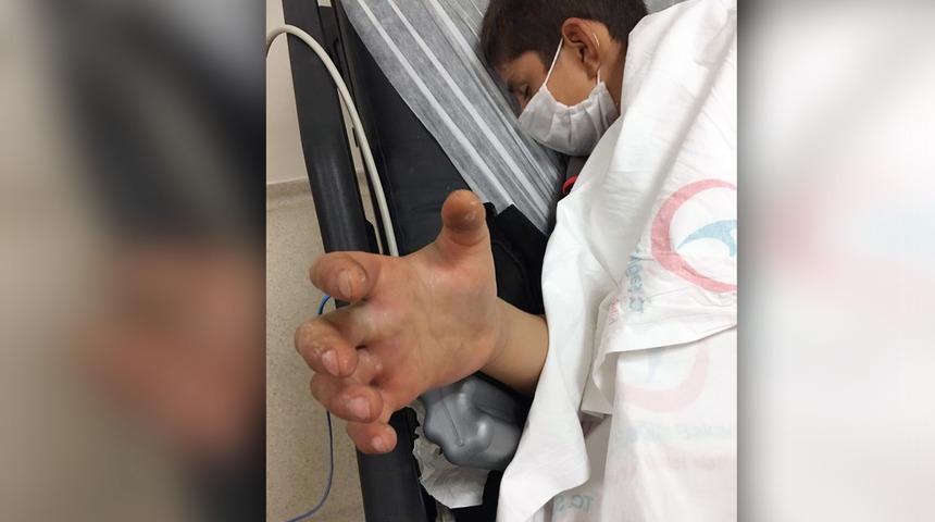 Arkadaşlarıyla oynarken yılan ısırdı! Civan, yoğun bakımda