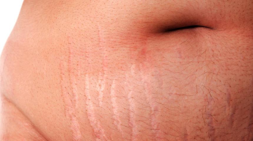 Kendini böyle belli ediyor sorunu artıran ise...