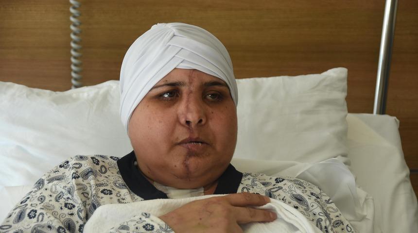 Eskişehir'de feci kaza! İkiye ayrılan y&uuml;z&uuml;, 10 saatlik ameliyatla birleştirildi