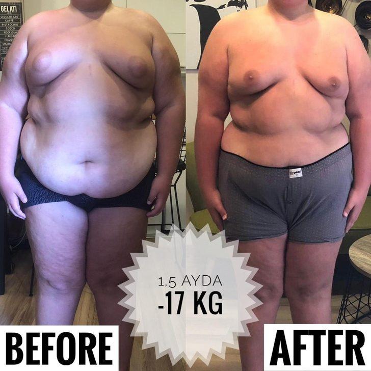 Hayatı zorlaştıran fazla kilolar artık sorun olmaktan çıkıyor G4