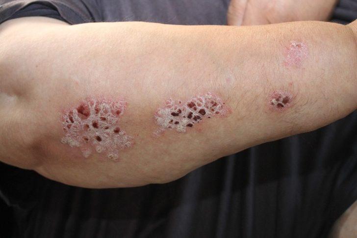 Zor durumdaki hastaya Karaman’dan şefkat eli G2