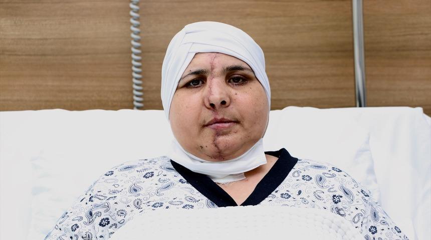 Suratı ikiye ayrılmıştı! 10 saatlik ameliyatla sağlığına kavuştu
