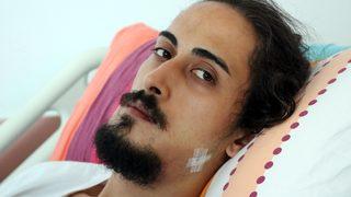 Sahilde gitar çalan tıp fakültesi öğrencisi dehşeti yaşadı! Çenesini kırdılar