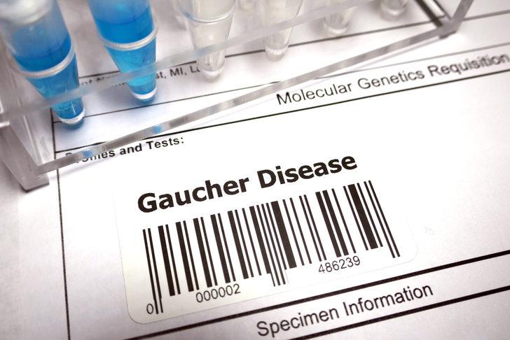 Doç. Dr. İlyas Okur: Lizozomal depo hastalıkları içerisinde en sık görülen Gaucher