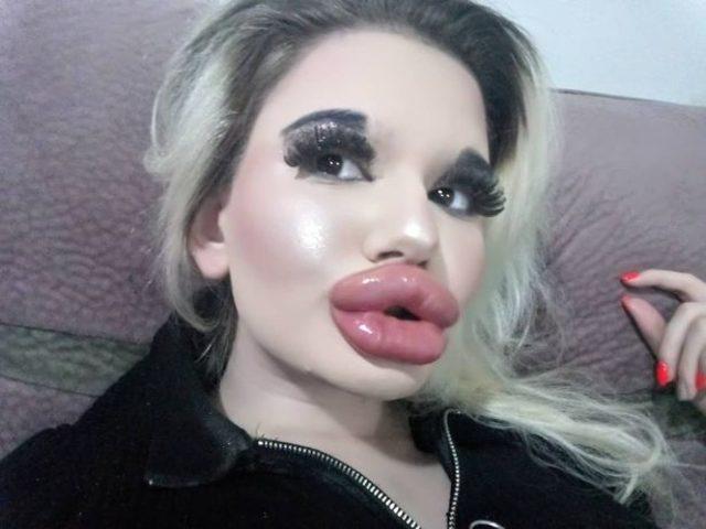 0_Real-life-Barbie-who-has-spent-thousands-in-an-attempt-to-get-the-biggest-lips-in-the-world-underg