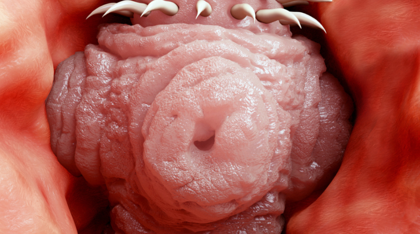  Baş ağrısının nedeni şaşkına çevirdi! Tümörün içi...