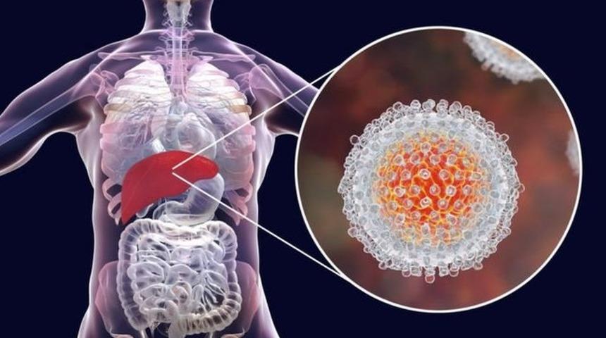 Nobel Tıp &Ouml;d&uuml;l&uuml;, Hepatit C vir&uuml;s&uuml;n&uuml;n keşfine katkıda bulunan 3 bilim insanına verildi