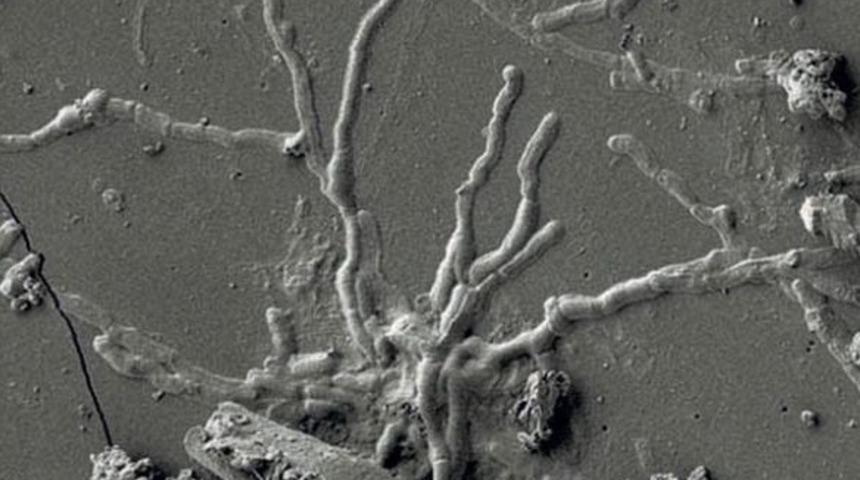 2 bin yıl &ouml;nceye ait kafatasından sağlam beyin h&uuml;cresi bulundu!