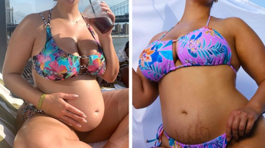 &Uuml;nl&uuml; kadınlar paylaştı! Doğumdan sonra nasıl g&ouml;r&uuml;n&uuml;yorlar?