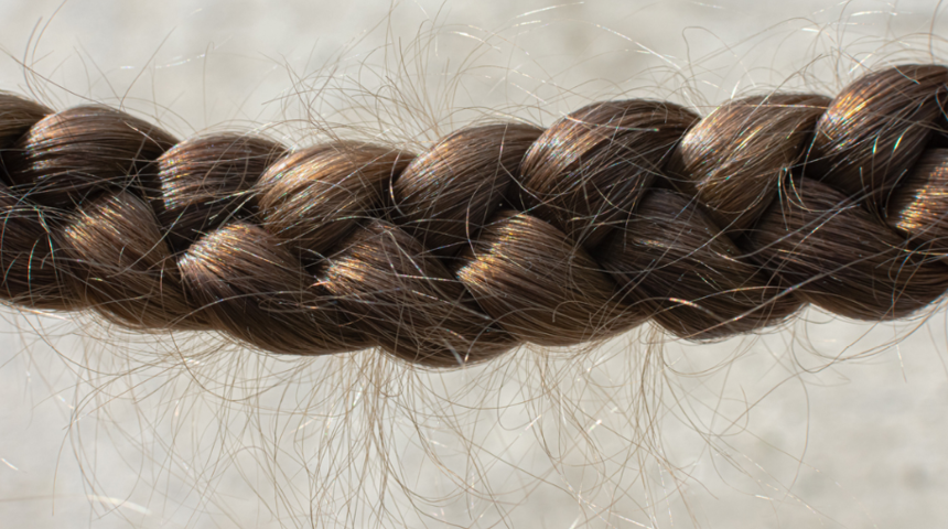 Saçınızı sıkı sıkı örmek bakın neye neden oluyor...