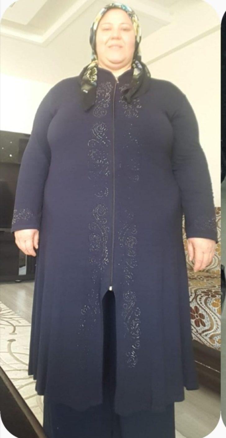 Anne-Kız fazla kilolarından obezite cerrahisi ile kurtuluyor G3