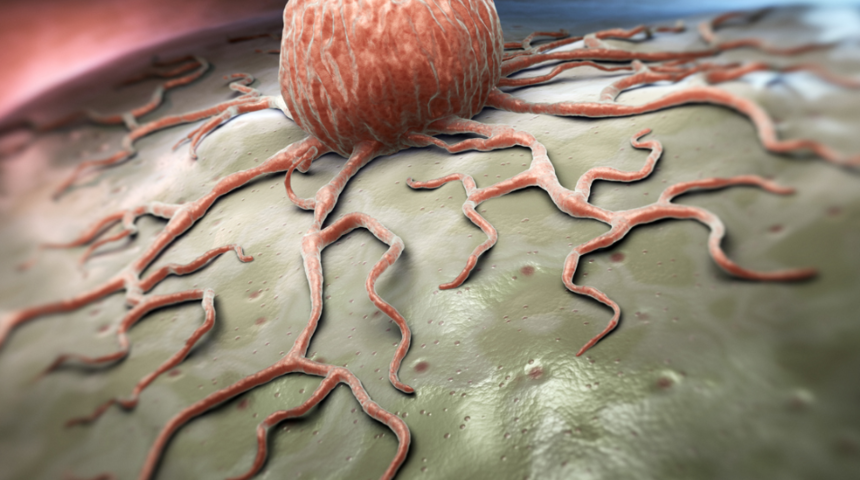 En sık belirtisi kitleler! 627 bin kişi bu yüzden hayatını kaybetti