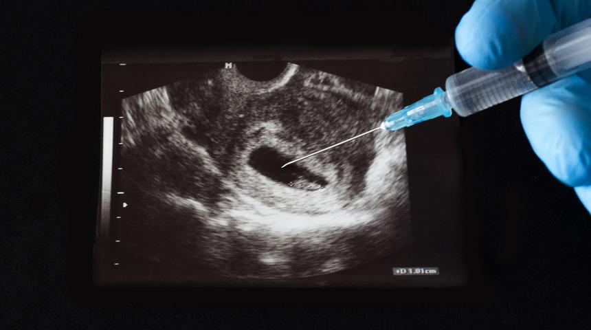 Arjantin'de kürtaj yasallaştı