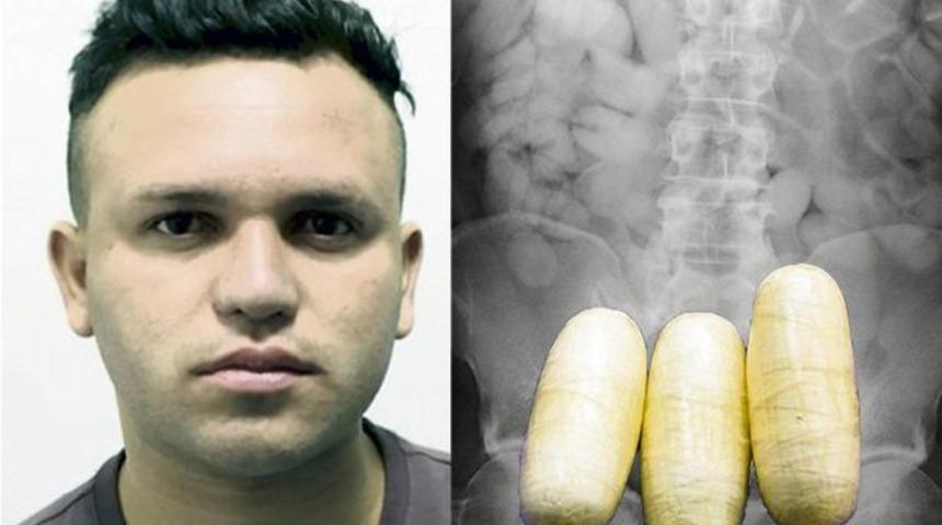 X-ray&rsquo;de &ccedil;ıkan g&ouml;r&uuml;nt&uuml;ye kimse inanamadı! 99 poşet kokain &ccedil;ıktı! 