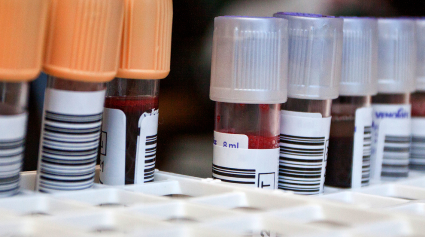 Kan uyuşmazlığına dikkat! Ciddi problemlere neden olabilir