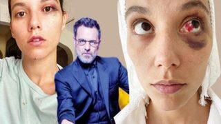 Ozan Güven'in darp ettiği Deniz Bulutsuz ilk kez görüntülendi