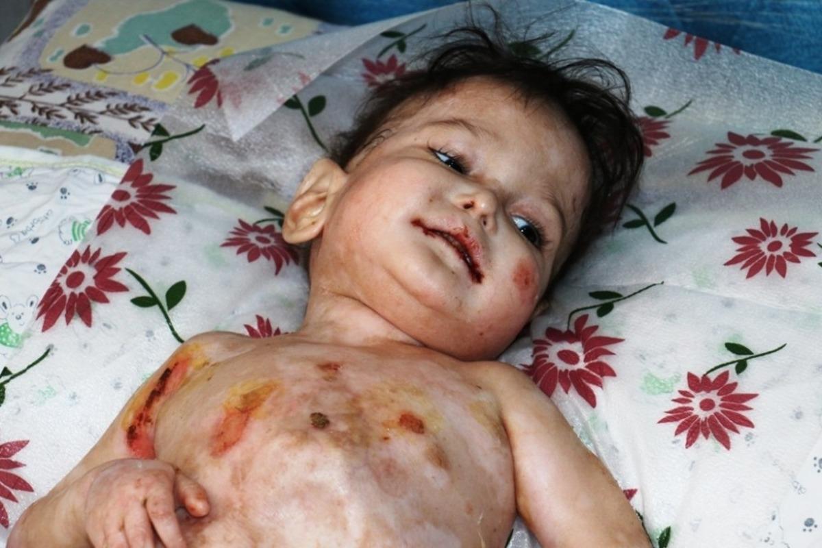 Yal&ccedil;ınkaya&rsquo;dan hasta bebeğin ailesine gıda yardımı