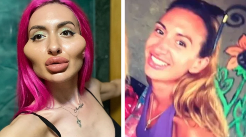 D&uuml;nyanın en b&uuml;y&uuml;k yanaklarına sahip olan kadın: Hala &ccedil;ok k&uuml;&ccedil;&uuml;k