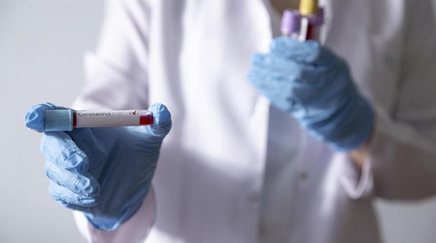 Rizespor'da iki futbolcunun Covid-19 test sonuçları pozitif