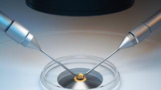 Mikroenjeksiyonun tüp bebek yönteminden farkı