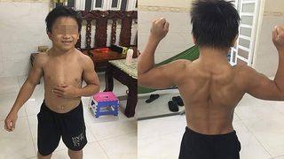 10 yaşındaki çocuk nadir hastalıktan dolayı vücut geliştirici gibi gözüküyor