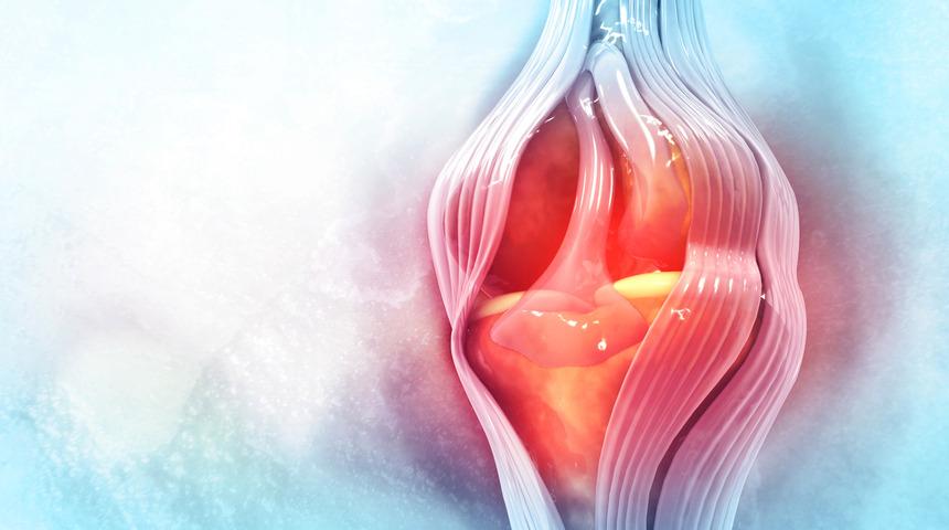 Uzmanlardan menisküs uyarısı: Tedavi geciktirilmezse...