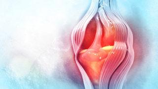 Uzmanlardan menisküs uyarısı: Tedavi geciktirilmezse...