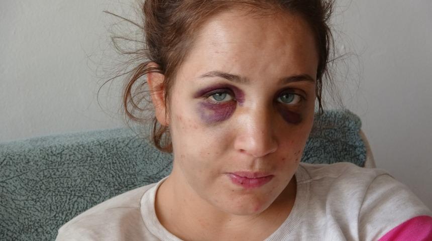 Boşanma aşamasındaki eşini darp eden kişiye elektronik kelepçe