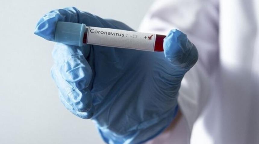 Kasımpaşa'da 7 futbolcunun testi pozitif çıktı