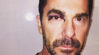 İlker İnanoğlu: Gözü patlattık