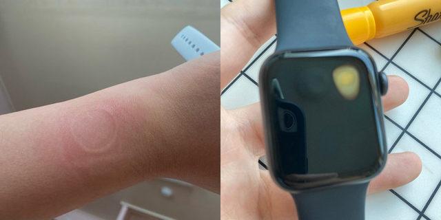 Apple Watch SE ısınma sorunu