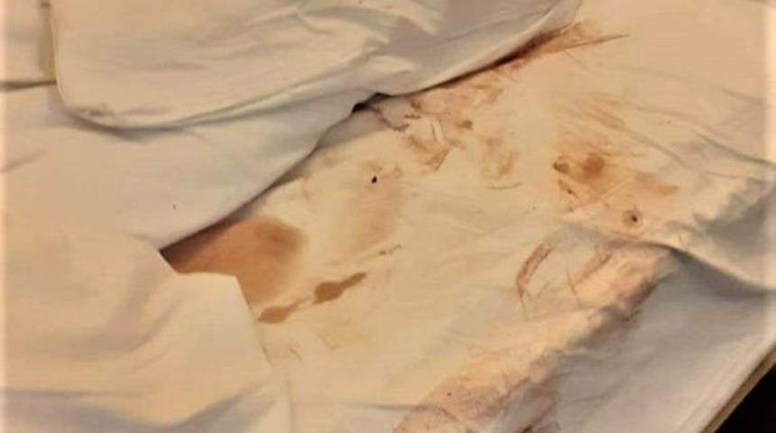 Korku filmi gibi: Her yer dışkı ve kan lekesiyle kaplı! 