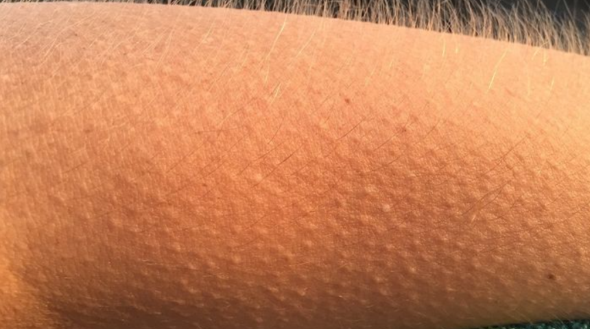 Tüylerimiz neden diken diken oluyor? Bilim insanları açıkladı