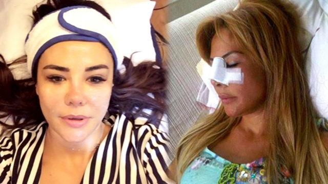 Ünlü ismin estetik sonrası görüntüsü şaşırttı