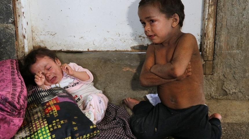 Balık pulu hastası kardeşler yardım bekliyor