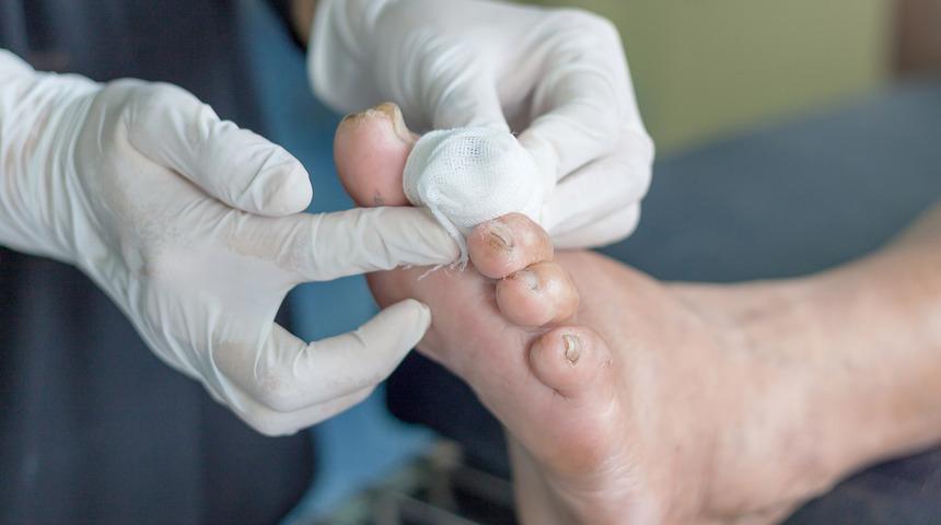 Çorap seçimine dikkat! Ağrıyla ortaya çıkıyor...