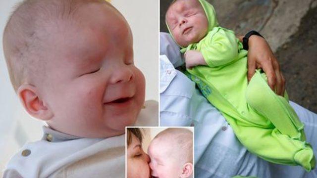 Gözleri olmadan doğan 'gülen' bebek annesi tarafından terk edildi 
