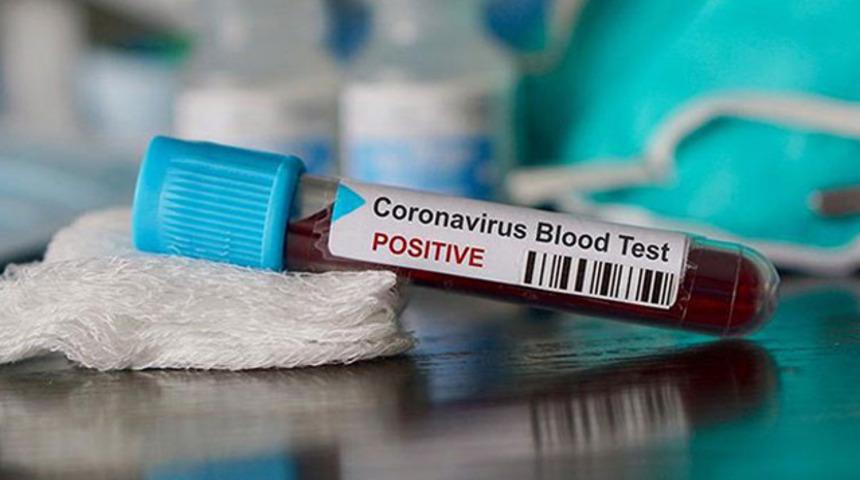 Ankaragücü'nde 2 pozitif vaka