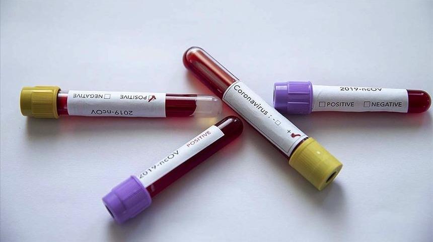 Kasımpaşa'da 2 oyuncunun testi pozitif