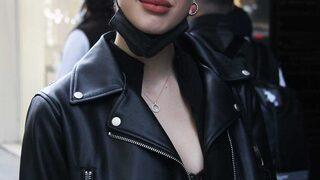 Itır Esen dudak dolgusu mu yaptırdı? 